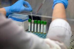 Mers, 9 casi con due morti in Arabia Saudita. Oms: “Rischio moderato”
