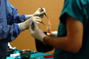 Ai prevede ricomparsa cancro fegato post-trapianto, sistema gratis online