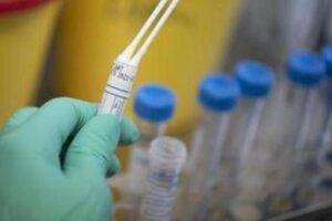 Legionella in case popolari a Milano, un morto e diversi ricoverati