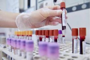 Melanoma, vaccino anti cancro a mRna dimezza rischio morte a 3 anni