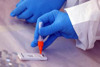 Test Covid, istruzioni per l’uso. I consigli dei microbiologi: “No a tamponificio”