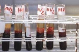 Salute, da Hiv a infezioni sessuali lotta a sommerso, al via settimana europea test