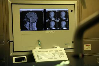 Operato a 7 anni con risonanza a ultrasuoni, a Milano ‘prima mondiale’