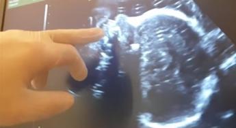 Alcol: 10% donne lo consuma in gravidanza, neonatologi ‘non c’è dose sicura’