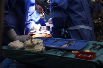 Trapianti, ‘un cuore per tre’: impiantato due volte lo stesso organo