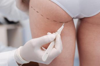 Chirurgia estetica, via l’Iva sugli interventi