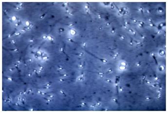 Infertilità maschile, dietro c’è gene mancante: spermatozoi sono ‘sconnessi’