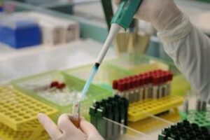 Morbillo, c’è una variante in Italia: cosa dicono gli esperti