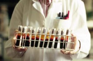 Da emofilia a linfomi, Roche presenta nuovi dati all’Ash 2023&nbsp;