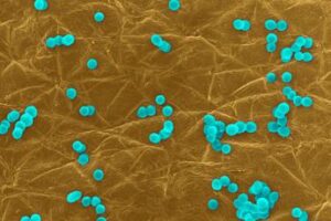 Infezioni da superbatteri costano circa 1 miliardo all’anno, roadmap con 10 priorità