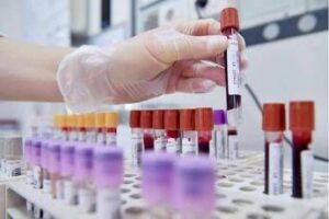 Alert su difterite in Ue, l’infezione continua a colpire in Europa