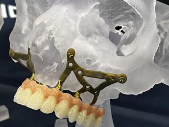 Dr. Claudio Mocci (Dent.AL.): “Nuovi traguardi per l’implantologia avanzata: dall’utilizzo di sistemi hi-tech all’approccio multi-disciplinare nutrizionale”