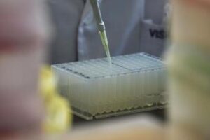 Alzheimer, scoperta nuova forma genetica: qual è il gene ‘incriminato’