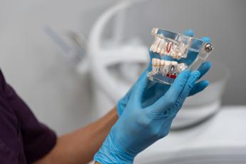 Implantologia dentale, in Italia nascono nuove tecniche e soluzioni pensate anche per i pazienti problematici