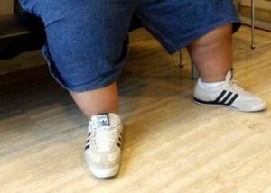 Iss, 40% adulti con problemi di peso, 1 su 10 è obeso