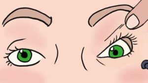 Ocularistica Italiana: eccellenza nella riabilitazione estetica oculare