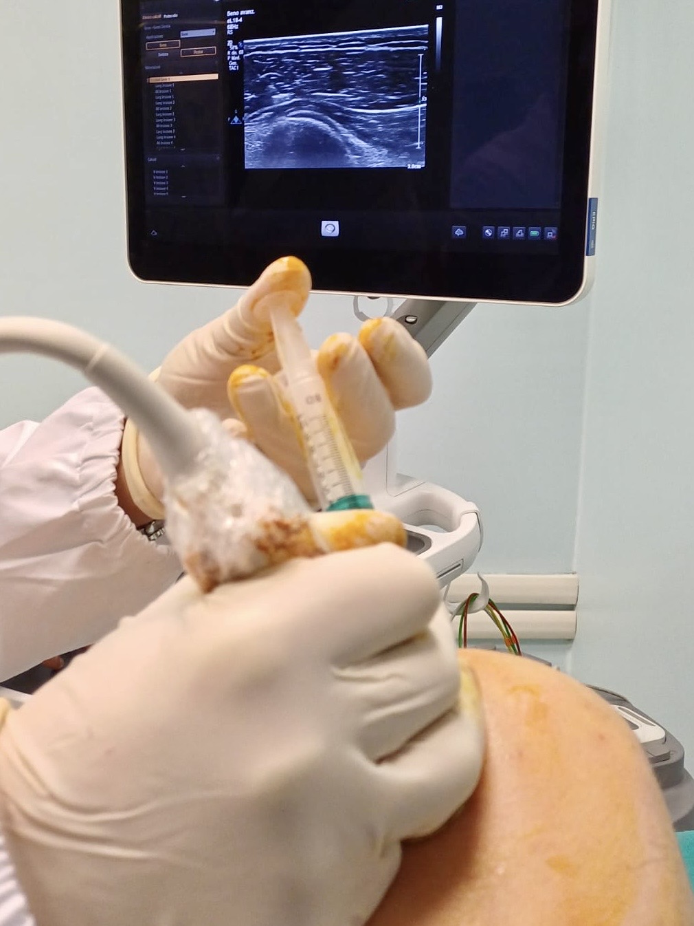 Artrosi e discopatie, la radiologia di Chieti all'avanguardia nei trattamenti