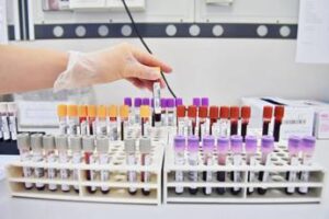 Uap: “Governo argini fondi Regioni a farmacie per attività pre-diagnostica”
