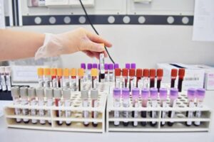 Uap: “Manifesteremo contro esami in farmacia, ministro Schillaci ci convochi”