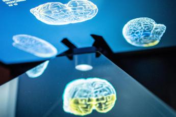 Alzheimer, Ema blocca farmaco Lecanemab: “Rischio di gravi effetti collaterali”