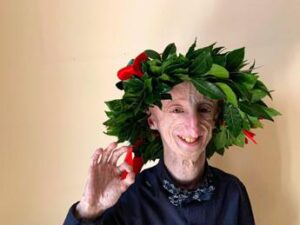 Morto Sammy Basso, il 28enne italiano malato di Progeria