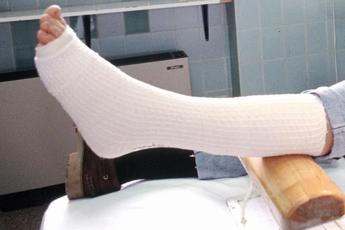 Diabetologi, ‘nel 2050 raddoppio fratture da osteoporosi’