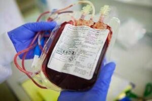 Tumori, da cordone ombelicale donato ecco cellule Carcik: nuova arma contro leucemia
