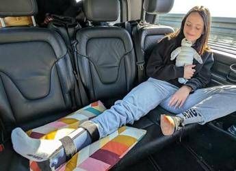 Francesca Michielin con il tutore prima di Sanremo: “Caduta dalle scale dell’Ariston”