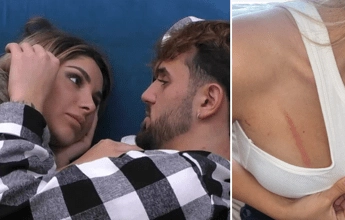 Alfonso D’Apice e Chiara Cainelli derubati dopo il GF: “Due ladre in casa, ci hanno aggrediti”