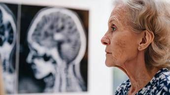 Giornata salute donne, Sin ‘prendetevi cura anche della salute neurologica’