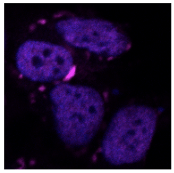 Ia, algoritmo Iit va a caccia di proteine dannose per il cervello