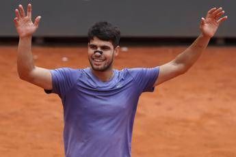 Internazionali, Alcaraz e il cerotto al naso: cos’è e a cosa serve