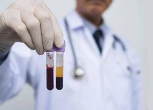 Farmaceutica, Gardini (GenomeUp): “Ai per programmare terapie con plasmaderivati”