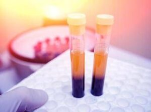 Farmaci, Sava (Sif Magazine): “In plasmaderivati attenzione particolare a sicurezza”
