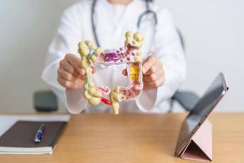 Tumori, Garufi (San Camillo): “Il tumore del colon retto si può prevenire ma l’adesione agli screening è troppo bassa”
