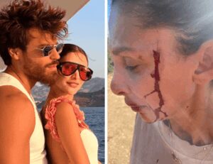Can Yaman, la fidanzata Sara Bluma denuncia le violenze dell’ex. L’attore: “Ti amo”