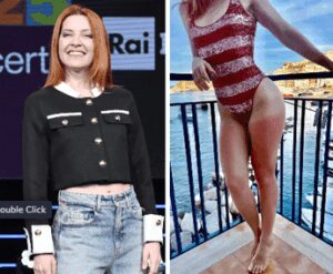 Dalla chioma alle gambe, Noemi ironizza sulla scottatura: “Mai senza crema”