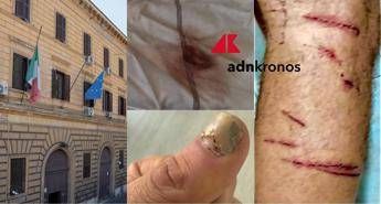 “Picchiato e sequestrato per due giorni da altri detenuti a Regina Coeli”, la denuncia choc