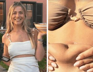 Ultimo, Jacqueline mostra la pancia a 8 mesi dal parto: “Amate il vostro corpo”