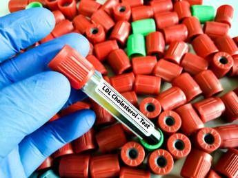 Colesterolo Ldl, per abbassalo in sviluppo nuova terapia con tripla combinazione&nbsp;