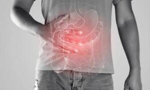 Malattie infiammatorie croniche, l’indagine: ‘4 pazienti su 5 non ricevono consulenze nutrizionali’