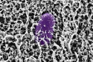 Scoperta del MIT: il muco contiene molecole che bloccano l’infezione da Salmonella