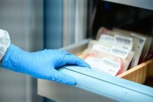 Leucemia mieloide cronica, esperto ‘asciminib per bisogni clinici irrisolti’
