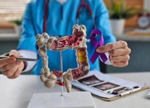 Tumori del colon retto, Int Milano in progetto Ue che punta a prevedere efficacia immunoterapia