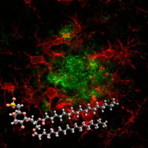 Alzheimer: una “molecola smart” del Cnr promette di rivoluzionare la terapia