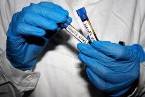 Hantavirus, Ema monitora diffusione: “Pronti a supportare iter vaccini”
