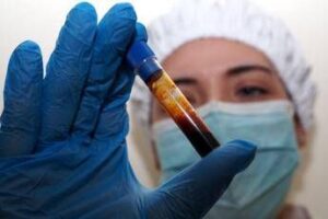 Hantavirus, negativo il turista inglese in quarantena a Milano. Test per una donna ricoverata a Messina