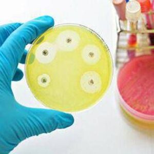 Ai e medicina di precisione per combattere super batteri resistenti, lo studio italiano su quasi 10.000 pazienti